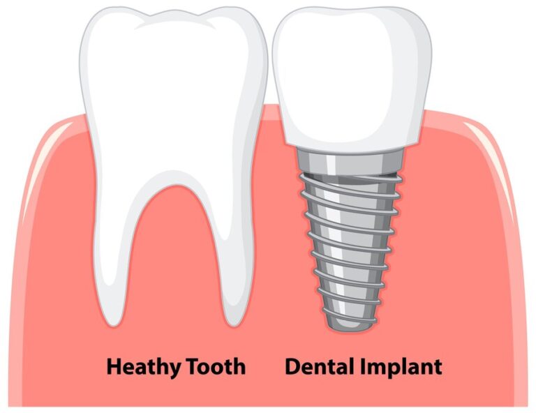 heathy tooth dental implant gum white background 1308 101598
