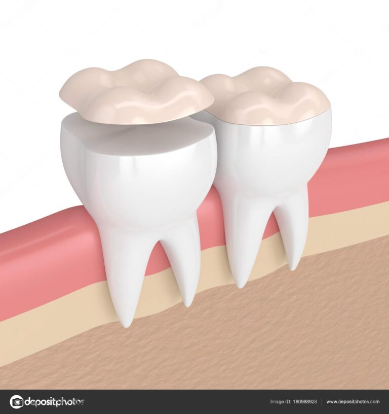 wmremove transformed 1