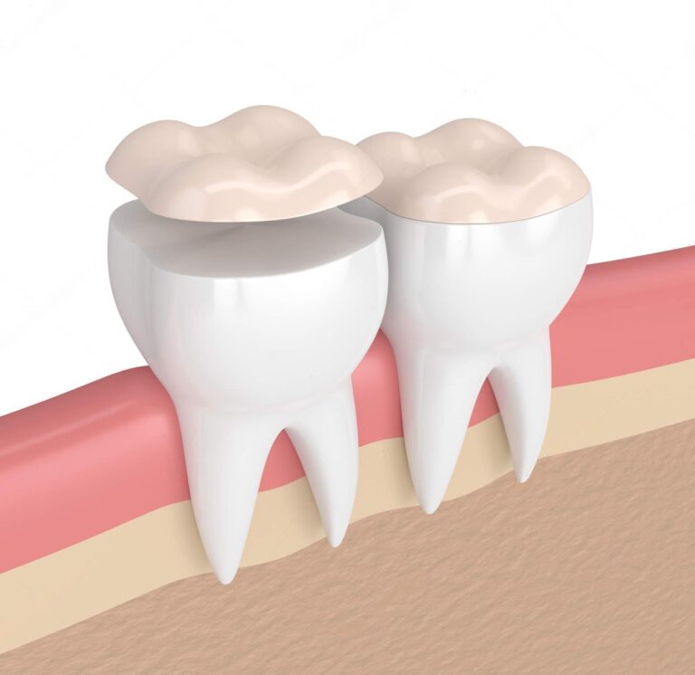 wmremove transformed 1 e1773161858267