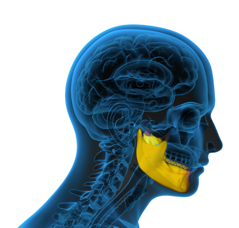 Jaw 1